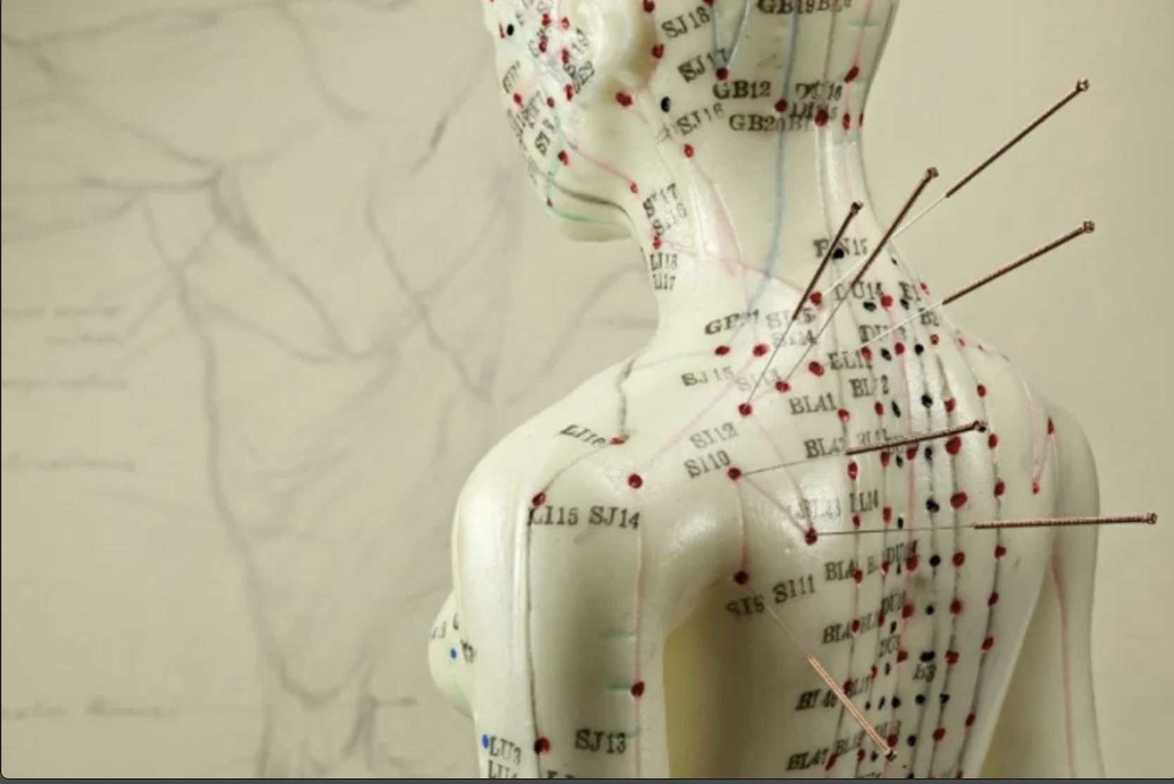 Acupuncture Points