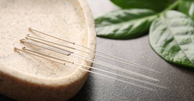 Acupuncture: What it is, how it works, what to expect during your treatments. image