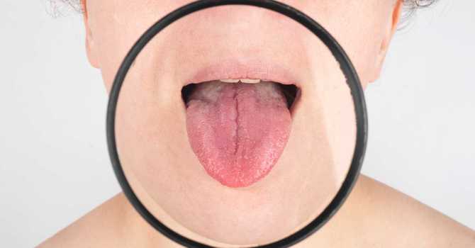 Why does your Acupuncturist look at your tongue? 