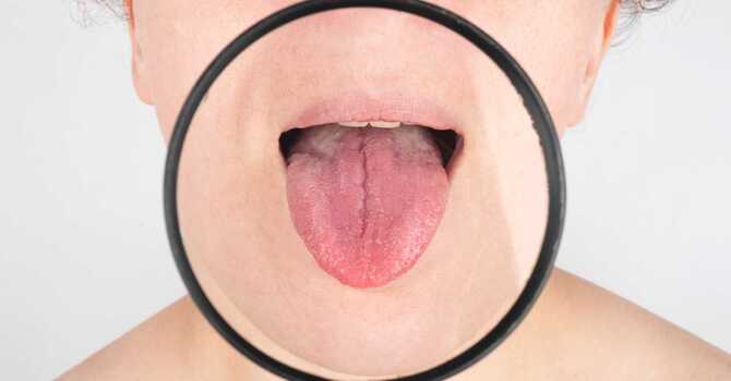 Why does your Acupuncturist look at your tongue?  image